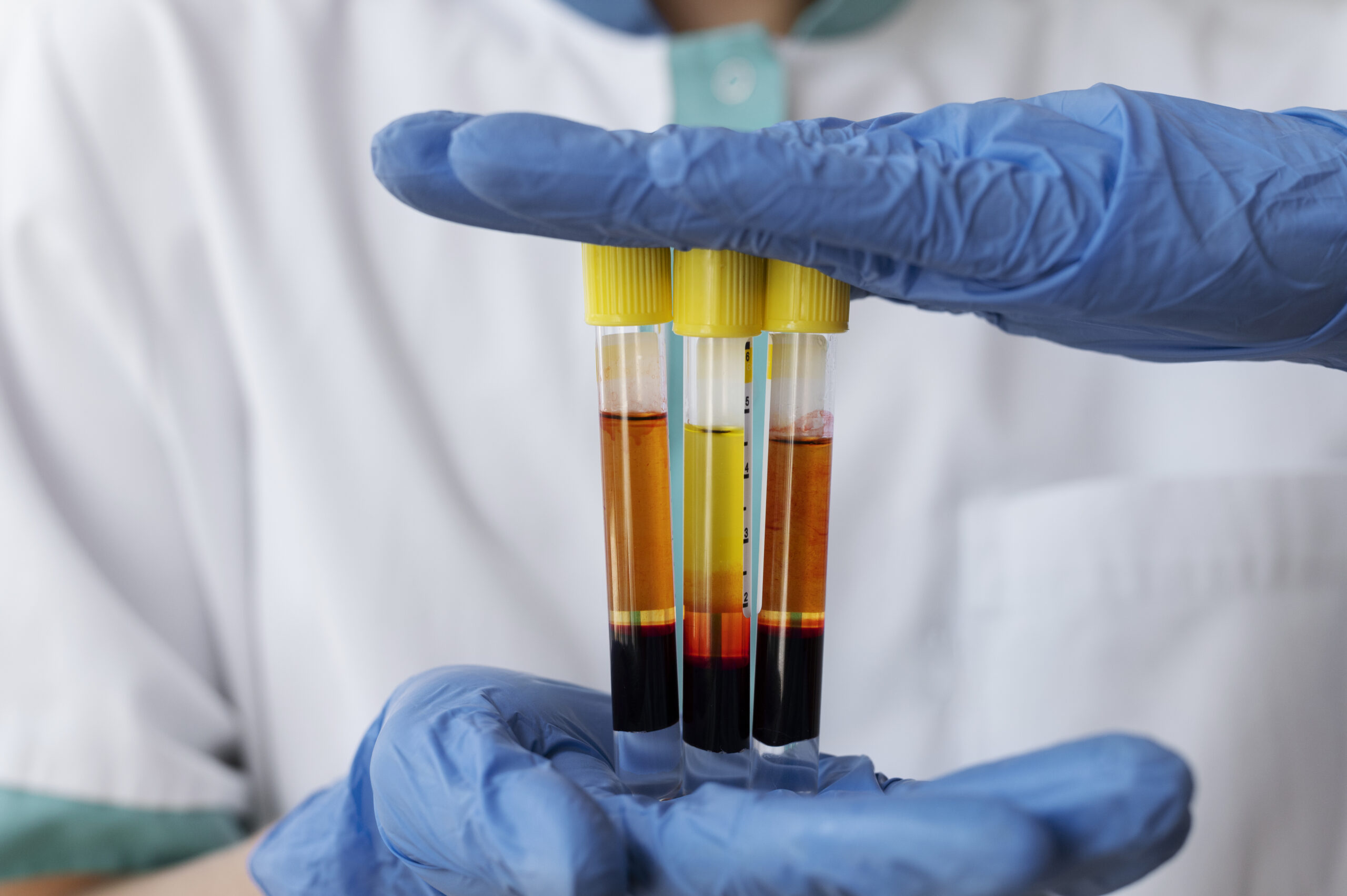 medico-de-vista-frontal-con-viales-para-tratamiento-de-prp