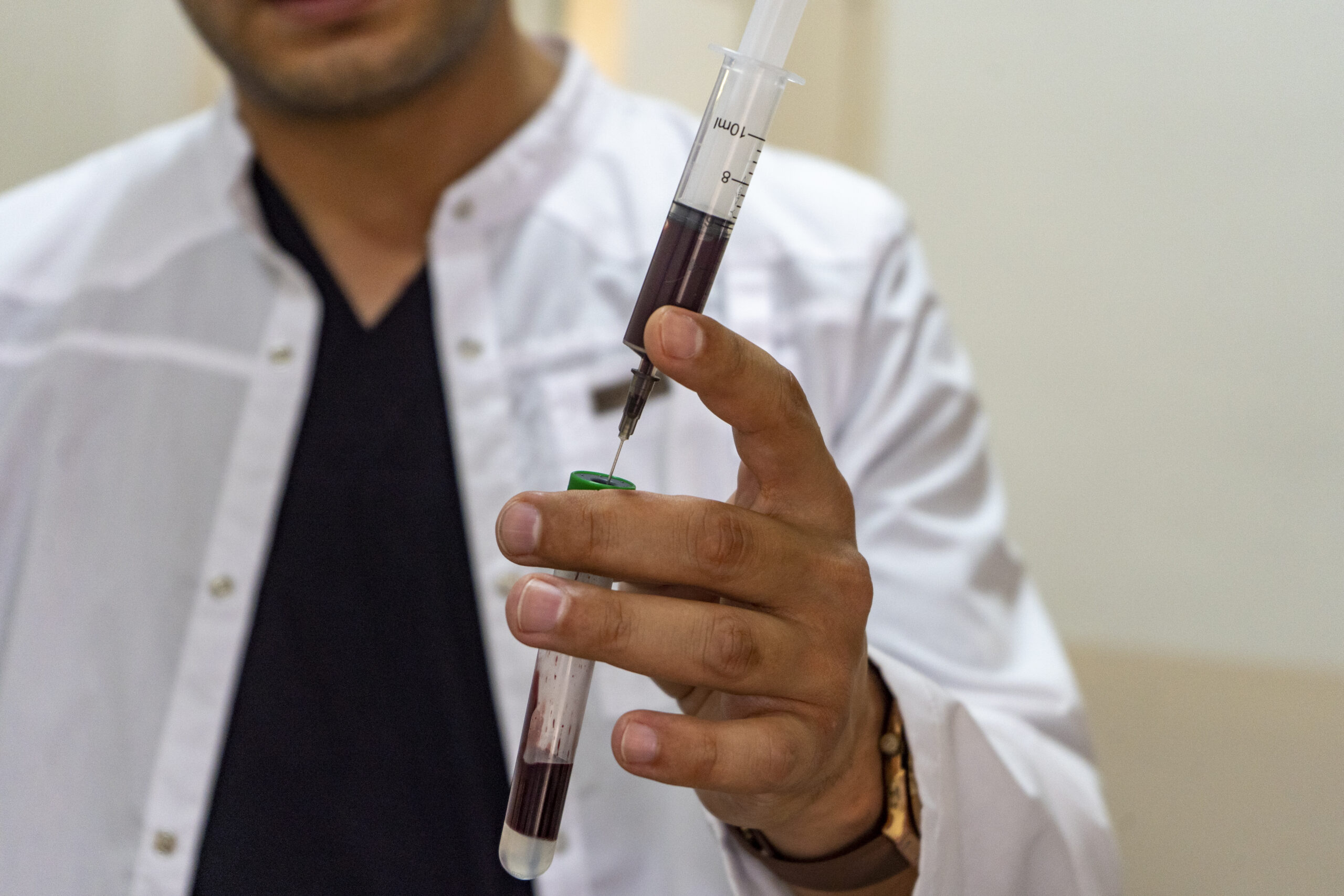 taken blood sample from a male patient,male doctor,10ml syringe,IV injection with blood transfer to vacutainer tubes slowly